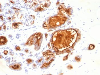 MUC1 / CA15-3 / EMA / CD227 (Epithelial Marker)(115D8),  CF640R conjugate, 0.1mg/mL