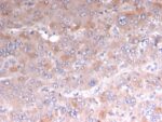 Adipophilin / Perilipin-2 (Marker of Lipid Accumulation)(rADFP/1493), 0.2mg/mL