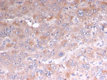 Adipophilin / Perilipin-2 (Marker of Lipid Accumulation)(rADFP/1493), 0.2mg/mL