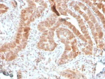 AKT1 (Prognostic Marker for Neuroendocrine Tumors)(rAKT1/2491), CF405S conjugate, 0.1mg/mL