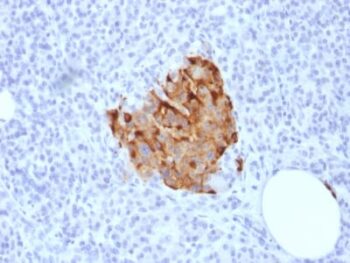 Chromogranin A / CHGA (Neuroendocrine Marker) (CHGA/1773R), 0.2mg/mL