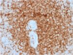 Bcl-2 (Apoptosis & Follicular Lymphoma Marker) (rBCL2/796), Biotin conjugate, 0.1mg/mL