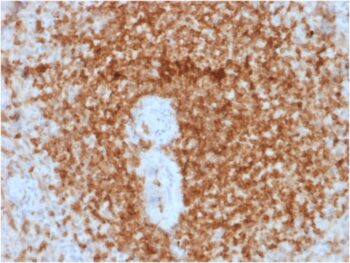 Bcl-2 (Apoptosis & Follicular Lymphoma Marker) (rBCL2/796), Biotin conjugate, 0.1mg/mL