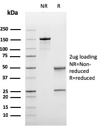 Bcl-6 (Follicular Lymphoma Marker)(rBCL6/1475), CF740 conjugate, 0.1mg/mL