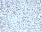 Bcl-6 (Follicular Lymphoma Marker) (rBCL6/1527), CF640R conjugate, 0.1mg/mL