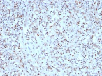 Bcl-6 (Follicular Lymphoma Marker) (rBCL6/1527), CF640R conjugate, 0.1mg/mL