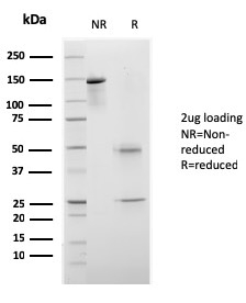 CELA3B / ELA3B (Pancreatic Function Marker)(rCELA3B/1811), CF405S conjugate, 0.1mg/mL