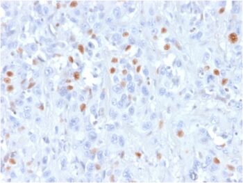 p21WAF1 (Tumor Suppressor Protein)(rCIP1/823), CF568 conjugate, 0.1mg/mL