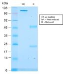 ACTH (Adrenocorticotrophic Hormone) (C-Terminus)(rCLIP/1418), CF647 conjugate, 0.1mg/mL