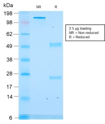 ACTH (Adrenocorticotrophic Hormone) (C-Terminus)(rCLIP/1418), CF647 conjugate, 0.1mg/mL
