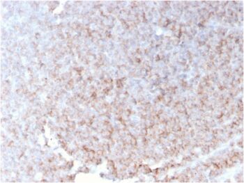CD21 (Mature B-Cell & Follicular Dendritic Cell Marker)(rCR2/1952), 0.2mg/mL