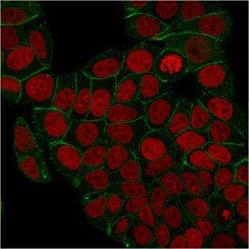 Catenin, gamma (Cardiomyocyte Marker)(rCTNG/1664), 0.2mg/mL