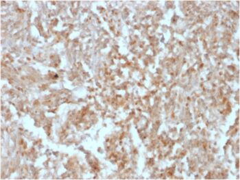 DOG-1 / TMEM16A (Gastrointestinal Stromal Tumor Marker)(rDG1/447), CF640R conjugate, 0.1mg/mL