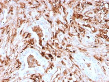 Ferritin, Light Chain (Node-Negative Breast Tumor Prognostic Marker)(rFTL/1388), 0.2mg/mL