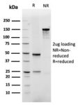 GLUT-1 (Tumor Progression and Mesothelioma Marker)(rGLUT1/2476), CF740 conjugate, 0.1mg/mL 1 view_image-750