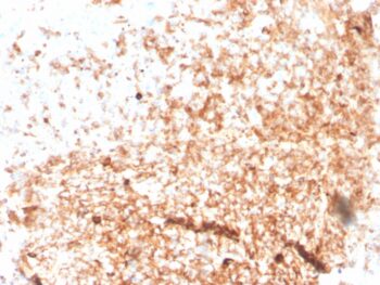 Human IgM (Immunoglobulin Mu Heavy Chain) (B-Cell Marker)(rIGHM/3802), CF640R conjugate, 0.1mg/mL