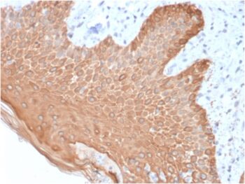 Cytokeratin, Multi (Epithelial Marker)(rKRT/457), Biotin conjugate, 0.1mg/mL