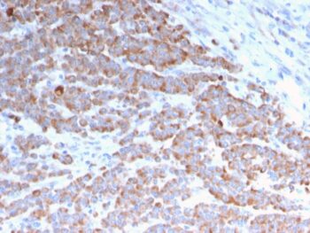 Cytokeratin 18 (KRT18)(rKRT18/1190), Biotin conjugate, 0.1mg/mL