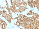 Cytokeratin 19 (KRT19) (Pancreatic Stem Cell Marker)(rKRT19/800), 1mg/mL 1 view_image-766