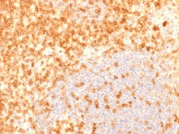 CD27 (Tumor Necrosis Factor Receptor Superfamily 7)(rLPFS2/1611), 1mg/mL