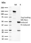 Spermidine or Spermine N1-Acetyltransferase 1(CPTC-SAT1-3), CF647 conjugate, 0.1mg/mL