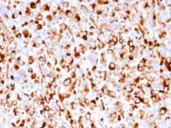 NGF-Receptor (p75) / CD271 (Soft Tissue Tumor Marker)(rNGFR/1965), CF488A conjugate, 0.1mg/mL