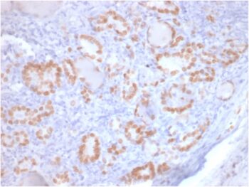 TTF-1 / NKX2.1 (Thyroid & Lung Epithelial Marker)(rNX2.1/690), 1mg/mL