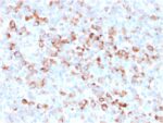 Tyrosinase (Melanoma Marker)(rOCA1/812), 1mg/mL