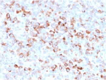 Tyrosinase (Melanoma Marker)(rOCA1/812), CF488A conjugate, 0.1mg/mL