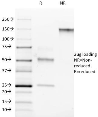 ROR-gamma / RORC (RAR-related Orphan Receptor C)(RORC/2942), CF740 conjugate, 0.1mg/mL