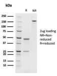 PAX8 (Renal Cell Marker)(rPAX8/1492), CF568 conjugate, 0.1mg/mL 1 view_image-796