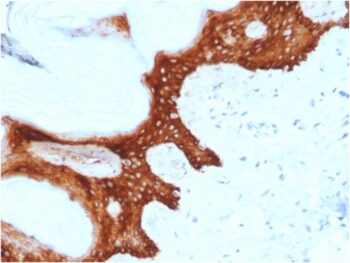 14-3-3 Sigma / Stratifin(CPTC-SFN-2), 0.2mg/mL