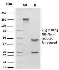Retinol Binding Protein-1 (RBP1)(rRBP1/872), CF647 conjugate, 0.1mg/mL