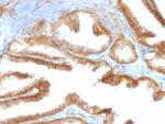 YBX1 / Y-box Binding Protein 1 / YB-1 (Tumor Biomarker)(rYBX1/2430), Biotin conjugate, 0.1mg/mL