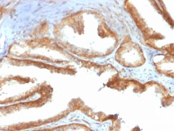 YBX1 / Y-box Binding Protein 1 / YB-1 (Tumor Biomarker)(rYBX1/2430), Biotin conjugate, 0.1mg/mL