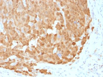 S100A1 (Melanoma Marker)(S100A1/1942), CF740 conjugate, 0.1mg/mL