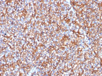 Spectrin beta III (SPTBN2) (SPTBN2/1778), CF488A conjugate, 0.1mg/mL