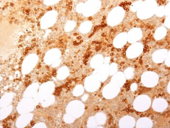 CD71 / Transferrin Receptor (TFRC) (Extracellular Domain)(TFRC/2898R), 0.2mg/mL