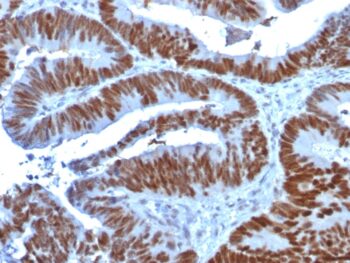 p53 Tumor Suppressor Protein (TP53/1739), 0.2mg/mL