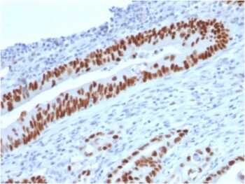 p53 (Tumor Suppressor Protein)(TP53/2719), 1mg/mL