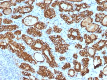TPO (Thyroid Peroxidase) (Thyroid Marker) (TPO/1922), CF640R conjugate, 0.1mg/mL