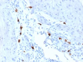 Tryptase (Mast Cell Marker)(TPSAB1/1963), 1mg/mL
