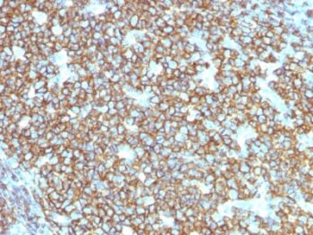 CD20 / MS4A1 (B-Cell Marker) (rIGEL/773), 0.2mg/mL