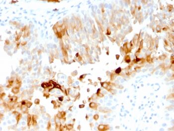 Uroplakin 1A (Urothelial Differentiation Marker)(UPK1A/2921), CF640R conjugate, 0.1mg/mL