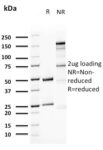 Uroplakin 1A (Urothelial Differentiation Marker)(UPK1A/2923), CF488A conjugate, 0.1mg/mL