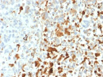 Vimentin (Mesenchymal Cell Marker)(VIM/1937R), CF740 conjugate, 0.1mg/mL
