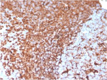 Vimentin (Mesenchymal Cell Marker)(VIM/3736), CF488A conjugate, 0.1mg/mL