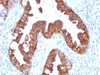 Cytokeratin 7 (Glandular and Transitional Epithelial Marker) (rOV-TL12/30), CF770 conjugate, 0.1mg/mL