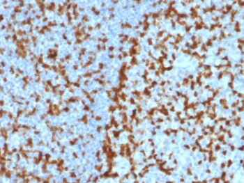 ZAP70 (Chronic Lymphocytic Leukemia Marker)(ZAP70/2047), CF405S conjugate, 0.1mg/mL