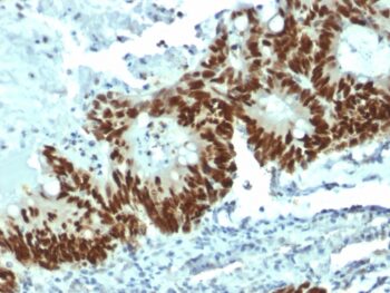 p53 Tumor Suppressor Protein(DO-1), 1mg/mL